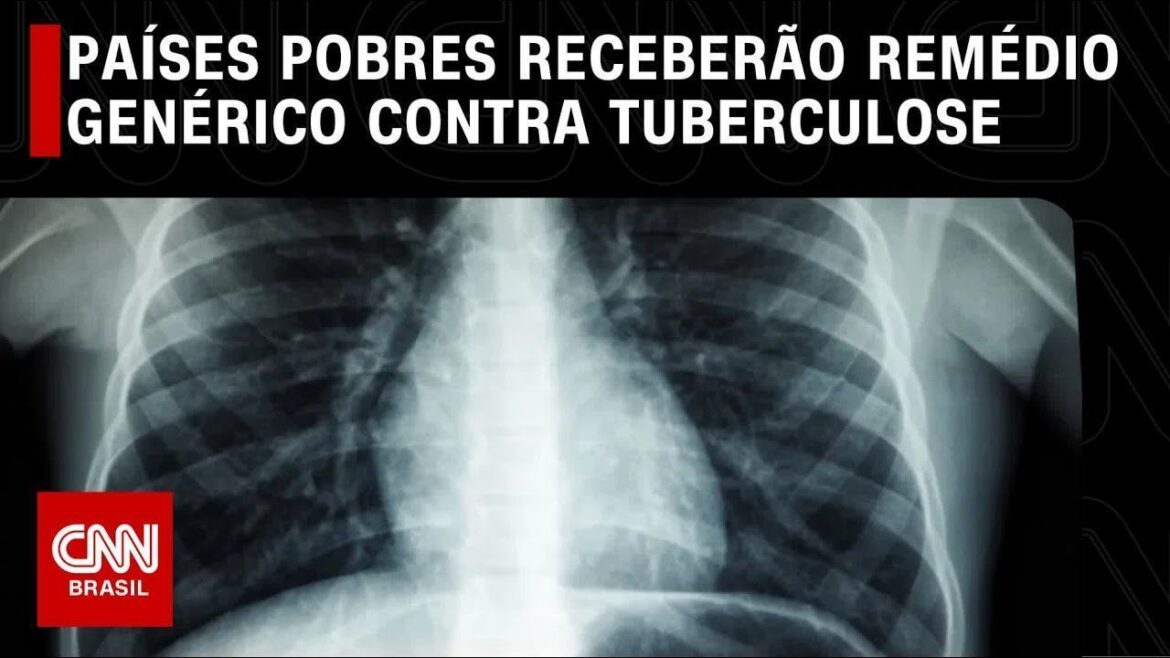 dia-mundial-da-tuberculose:-saiba-como-e-feito-o-diagnostico-da-doenca